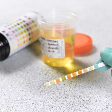 Synthetic Urine: A Safe Solution for Simulating Human Urine in Labs